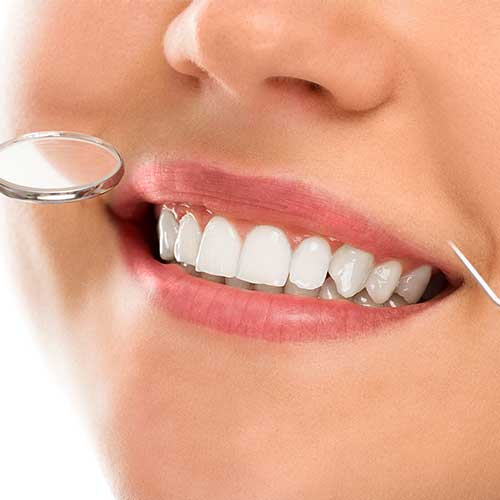 Accessori-per-la-pulizia-dei-denti