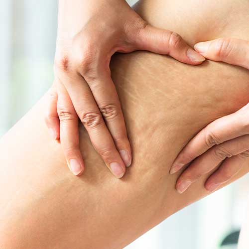 Anticellulitesmagliaturerassodanti